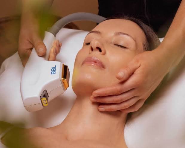 BBL photorejuvenation