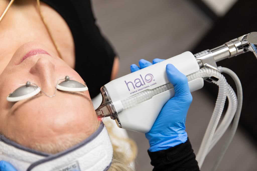 Halo hybrid laser